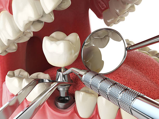 Best Emergency Denture Repair in Opelika, AL